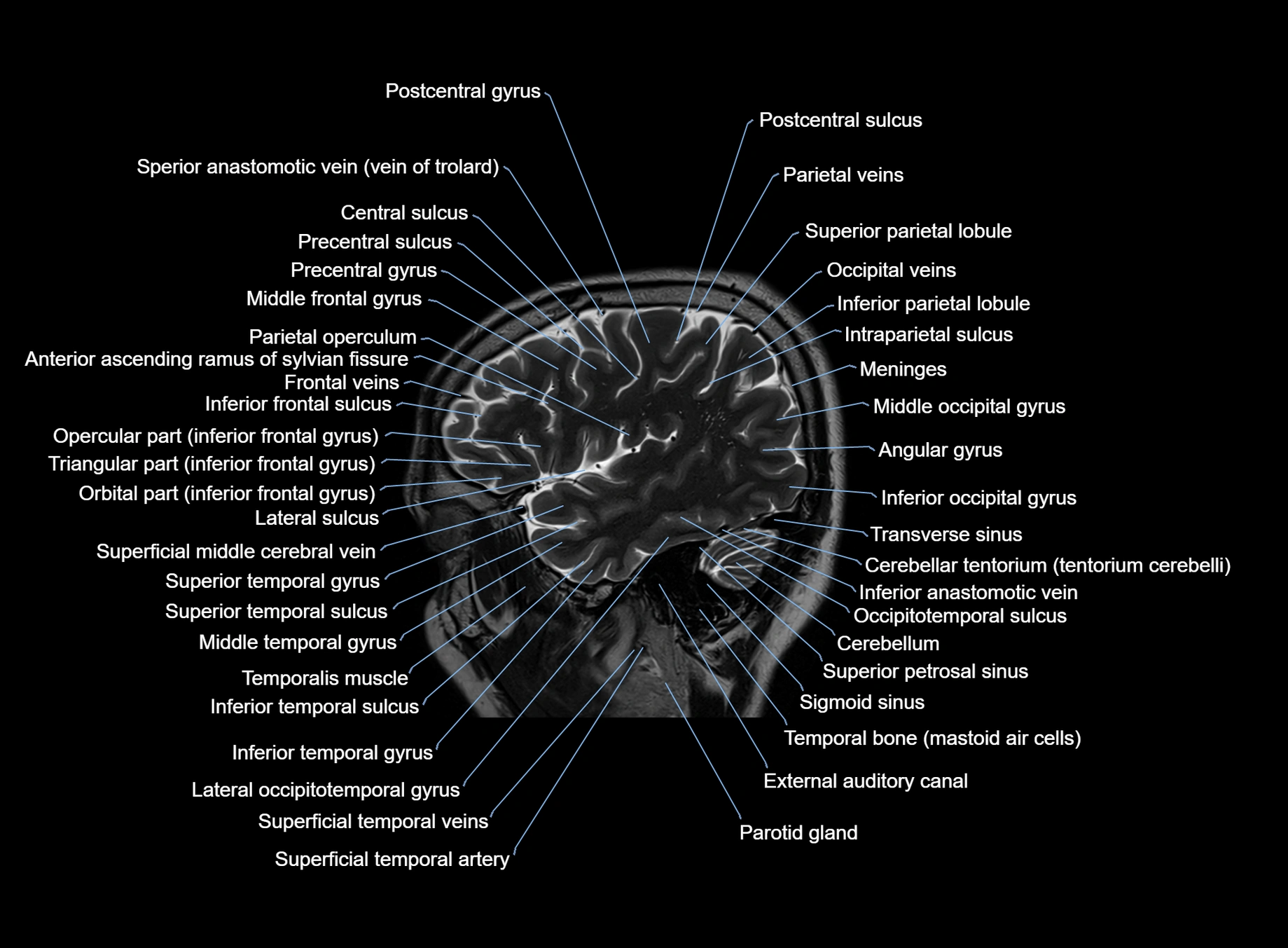 brain sagittal anatomy 3T MRI images -img-00001-00014.webp